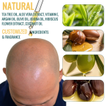 Hair Growth Oil - Vitamin E Baldness Treatment