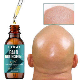 Hair Growth Oil - Vitamin E Baldness Treatment