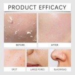 Men's Skincare Set - Glycerin Hyaluronic Acid Dry Skin