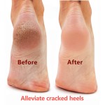 Foot Cream - Horse Oil Moisturizing Massager