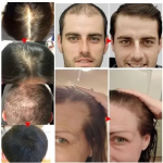 Hair Oil 30ml - Batana Rosemary Growth Essential