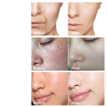 Beauty Set - Pomegranate Hyaluronic Acid