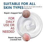 Urea Cream 40% - Salicylic Acid Callus Remover