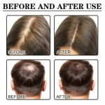 Hair Oil 30ml - Batana Rosemary Growth Essential