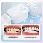 Toothpaste 100g - Niacinamide Whitening Formula