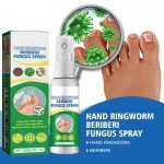 Foot Spray 30ml - Antifungal Treatment Formula