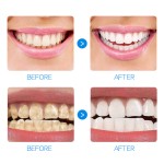 Teeth Whitening Kit - Natural Plaque Removal