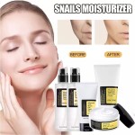 Skin Care Set - Nicotinamide Arbutin Whitening