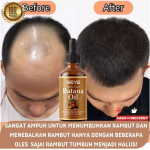 Hair Oil 30ml - Batana Rosemary Growth Essential