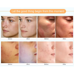 Lip Care Set - Honey Sakura Overnight Balm