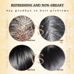 Shampoo - Dead Sea Salt Anti Dandruff Scalp