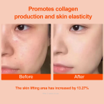 Ectoin Serum - Wholesale Probiotic Firming Rejuvenation