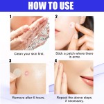 Acne Patch - OEM Hydrocolloid Pimple Treatment Supplier
