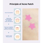 Acne Patch - OEM Hydrocolloid Pimple Treatment Supplier