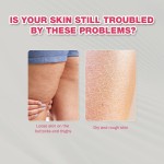 Wart Care Spray 20ml - Bee Venom Glycolic Acid