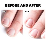 Wart Care Solution 20ml - Bee Venom Keratosis