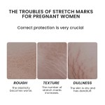 Anti Stretch Marks Oil Factory - MULAN Organic Nourishing Smooth Honey