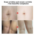 Skincare Essence Oil Manufacturer - MULAN Women Stretch Mark Dry Skin