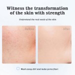 Facial Cleanser Manufacturer - MULAN Vegan Niacinamide Amino Acid Deep