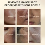 Skin Care Toner Manufacturer - MULAN OEM Private Label Whitening Antioxidant