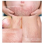 Massage Oil Manufacturer - MULAN Organic 30ml Nourishing Stretch Mark