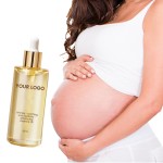 Skincare Essence Oil Manufacturer - MULAN Women Stretch Mark Dry Skin