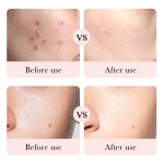 Moisturizing Toner Factory - MULAN Private Label Rose Hyaluronic Acid