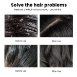 Anti Dandruff Shampoo Factory - MULAN Soapnut Extract Prickly Pear