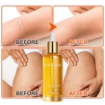 Massage Oil Manufacturer - MULAN Organic 30ml Nourishing Stretch Mark