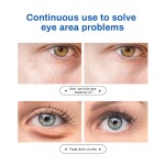 Eye Essence Oil Factory - MULAN Anti Aging Remove Dark Circles