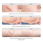 Anti Scar Gel Factory - MULAN Silicone Oil Old Scars Removal Prevention