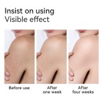 Body Essence Oil Manufacturer - MULAN Natural Rose Vitamin E Nourishing