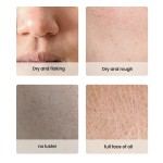 Skin Care Set Factory - MULAN Custom Acne Treatment Korean Style