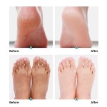 Foot Scrub Factory - MULAN Exfoliating Cream Pedicure Callus Dissolving