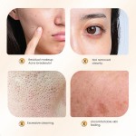 Blackhead Essence Manufacturer - MULAN Private Label Exfoliating Oil