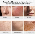 Face Cream Factory - MULAN OEM Whitening Brightening Hydrating 100ml