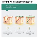 Bodymist Fragrance Manufacturer - MULAN OEM Antiperspirant Purifying