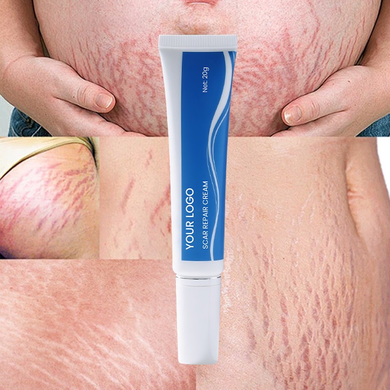 Anti Scar Gel Factory - MULAN Silicone Oil Old Scars Removal Prevention