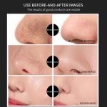 Nose Mask Supplier - Private Label Mineral Pore Shrinking