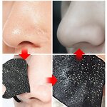 Nose Strips Supplier - OEM 10pcs DIY Breathing
