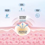 Pimple Patches Manufacturer - Wholesale Hydrocolloid Acne