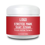 Stretch Mark Cream Factory - OEM 100ML Organic