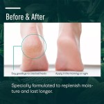 Urea Cream Supplier - Bulk 40% Cracked Heels