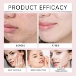 Vitamin C Mousse Supplier - OEM Hyaluronic Acid Brightening