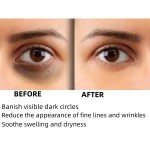 Dark Circle Eye Cream Factory - Custom 20g Caffeine Formula