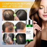 Hair Growth Essence Manufacturer - Bulk Plant Promotes
