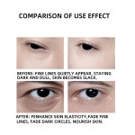 Anti-Aging Eye Cream Factory - Custom Silky Soft Formula