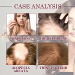 Red Onion Oil Factory - Custom Scalp Nourishing Serum