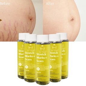 Stretch Marks Oil Supplier - Natural Ingredients Body Peeling