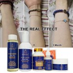 Skin Care Set Supplier - Private Label 5 Days Vitamin C